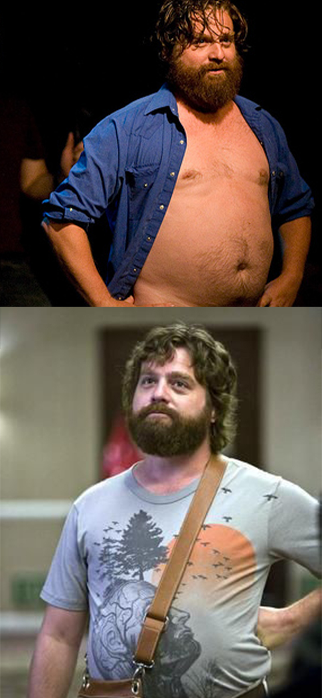 1. Zach Galifianakis Was Sick And Tired Of Being Overweight. 