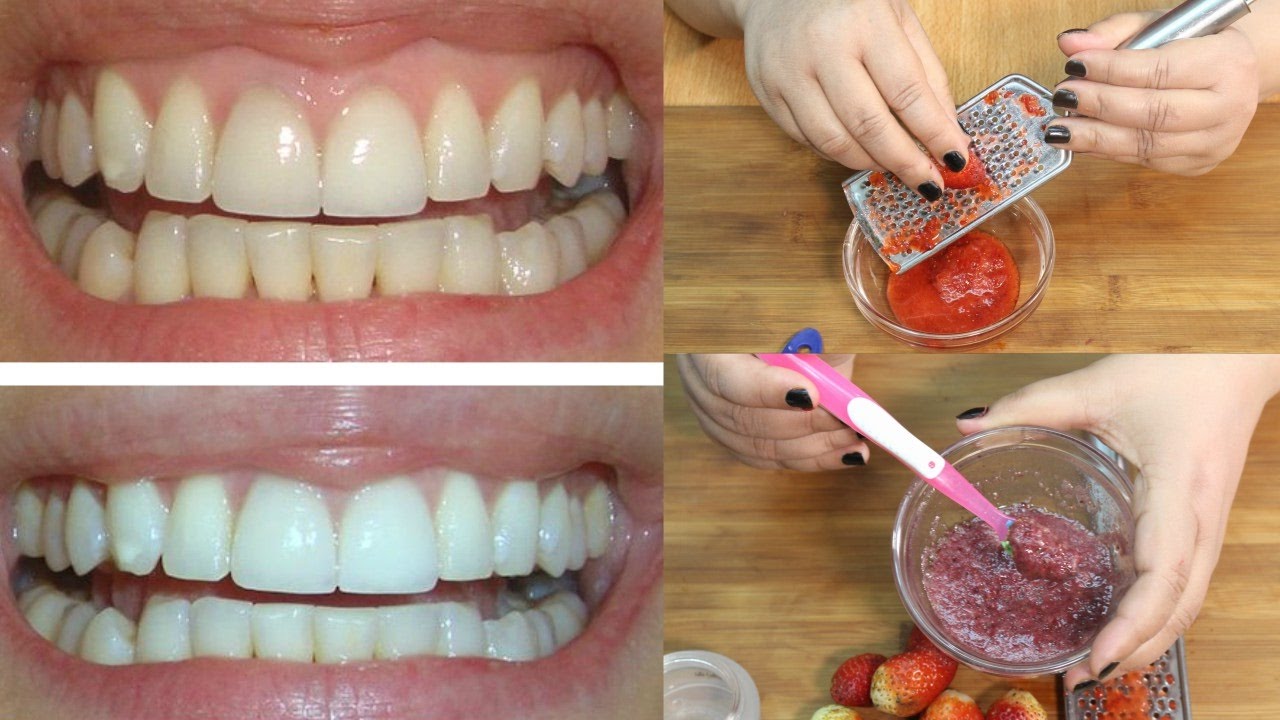Зуб отбеливание пить. Отбеливание зубов. Кауотбелить зубы. Отбеливание зубов домашнее отбеливание. Как отбелить зубы в домашних условиях.