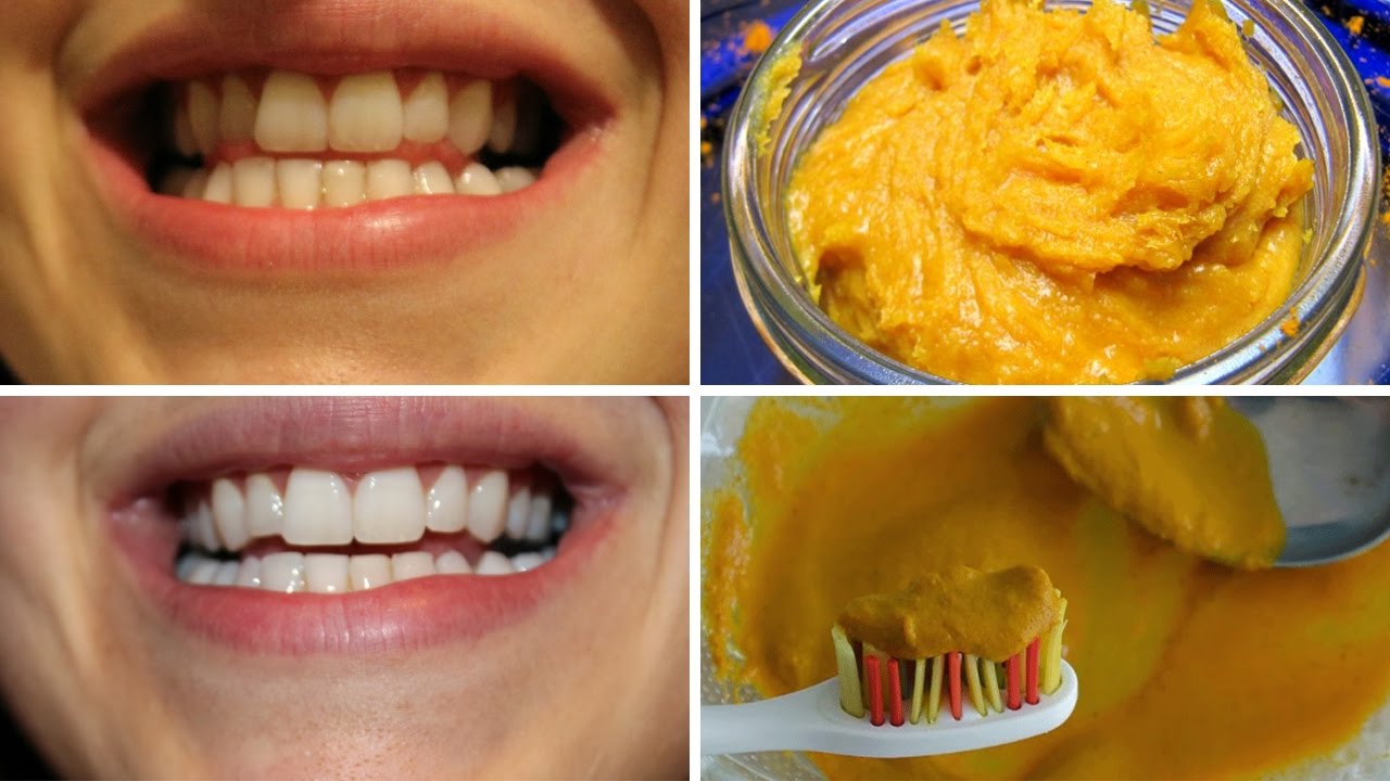 Как можно отбелить зубы в домашних условиях. Желтые зубы отбеливание. Отбеливание зубов куркумой.