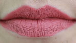 dry lips