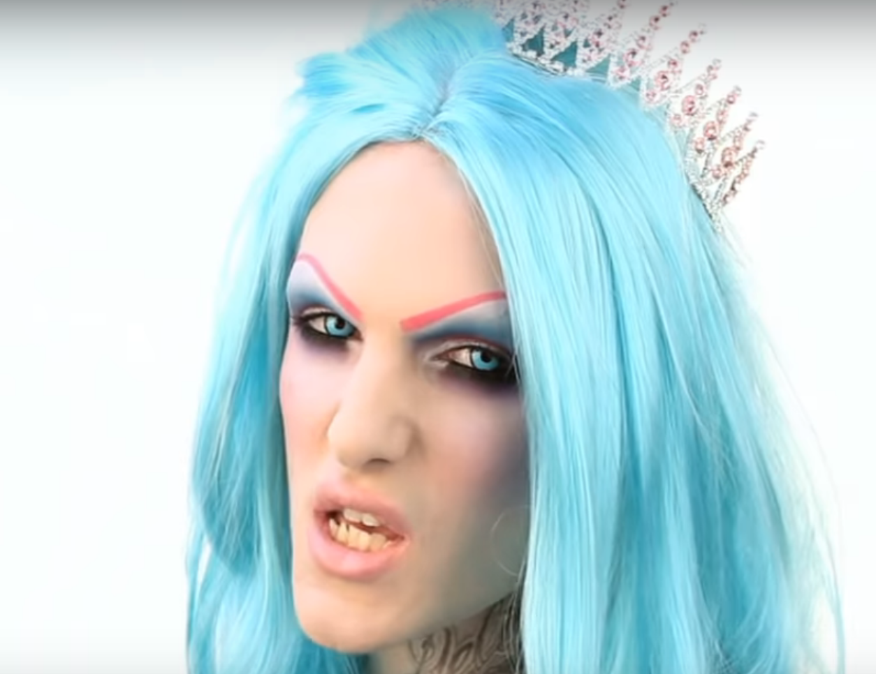 jeffree star with his old teeth.