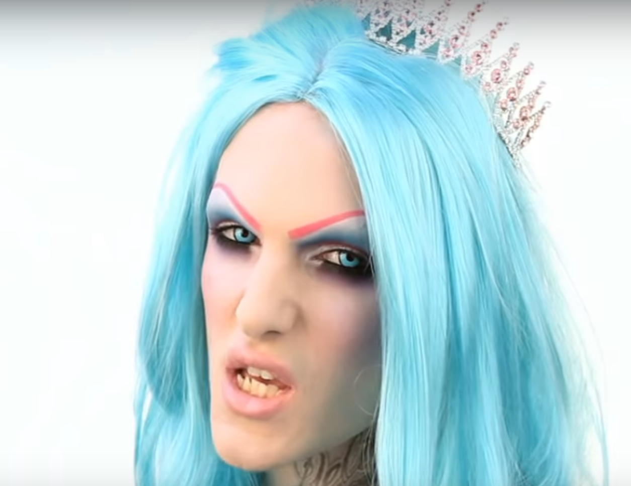 jeffree star with his old teeth 