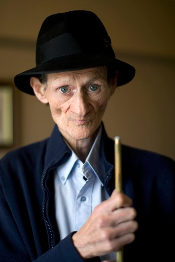 Alex Higgins in the final few years of his life.