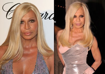 Donatella Versace Plastic Surgery: How much work has the designer had?