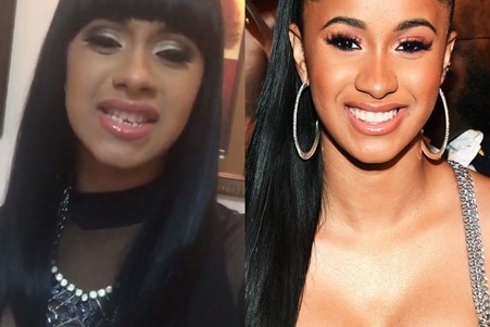 Cardi B Teeth Before and After: The rapper’s insecurities.