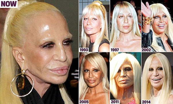 Donatella Versace Plastic Surgery: Her years of Botox and fillers.