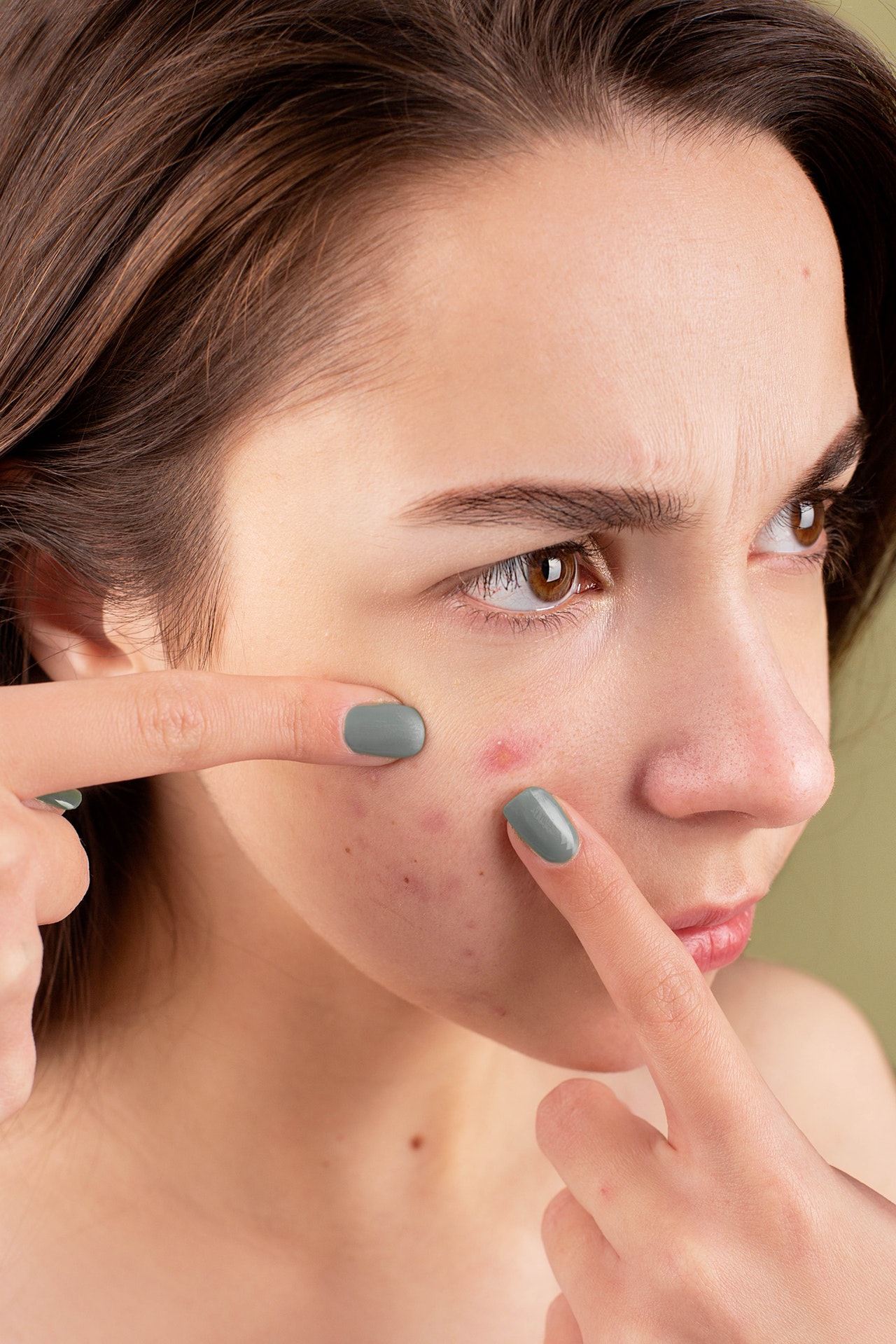 Woman Squeezing Pimples